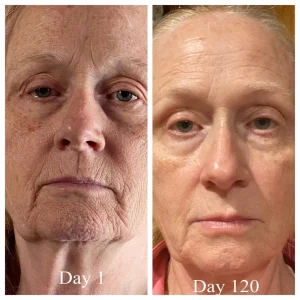 collagen-120days